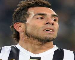Tevez faced a deadly accident as a child. He was third-degree burned when he fell into boiling water. He was kept in the intensive care unit for two m